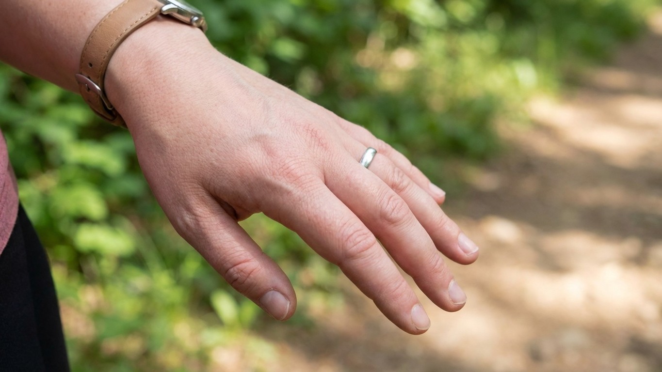 Why Your Hands Swell During Long Walks—And What Your Body Is Actually Telling You